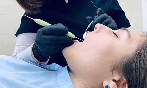 Root Canal Therapy